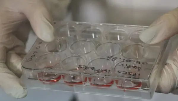 Israel prepara el primer implante en humanos de médula espinal diseñada en laboratorio 2 Medula UTA 3